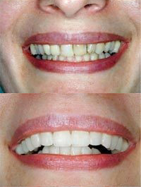 dental before and after 3