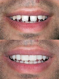 dental before and after 7