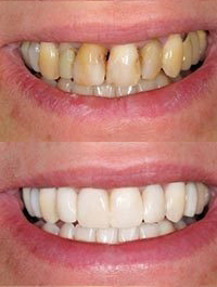 dental before and after 8