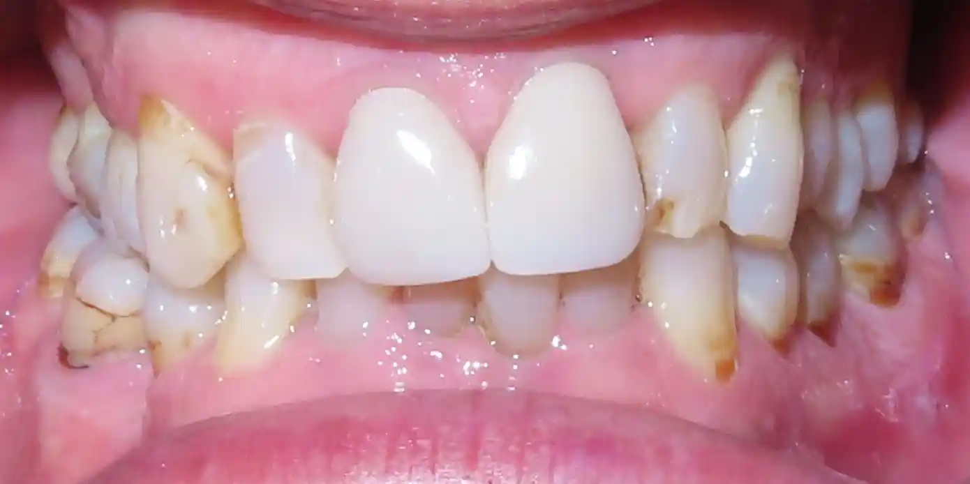 BDC Patient Before Photo